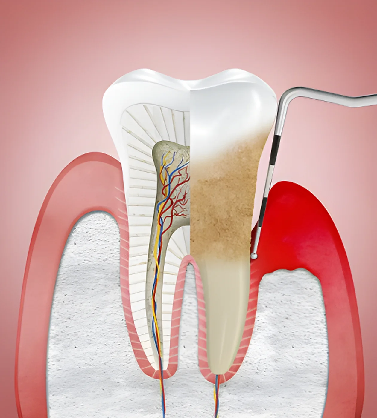 ПАРАДОНТОЛОГІЯ
